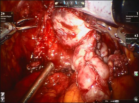 a514240e5a0f3d95db8fac73af882937.png 图片2.png