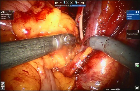 c0f87d4749705ef9d0ab37eca49f89b5.png 图片4.png