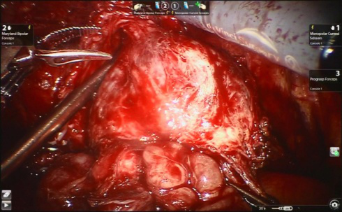 e991e5baa1c93cca2e24e8b994dae011.png 图片1.png