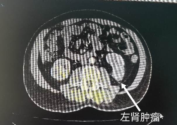 30c13262ab6a380bd1009b771f51ba7e.jpg 2.jpg