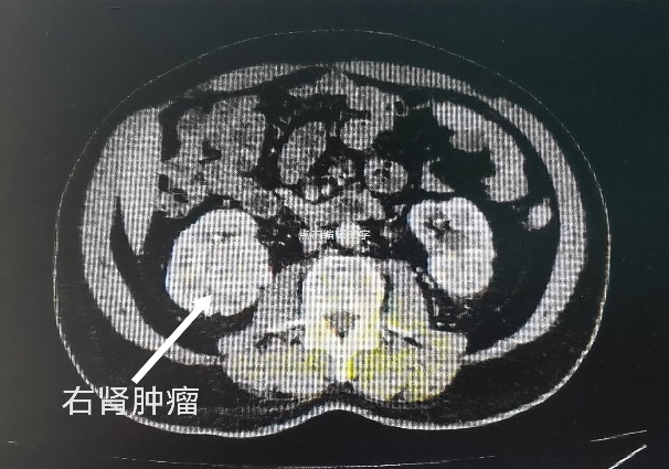 3304f75919187f9c4ab0378ab997ac8a.jpg 3.jpg