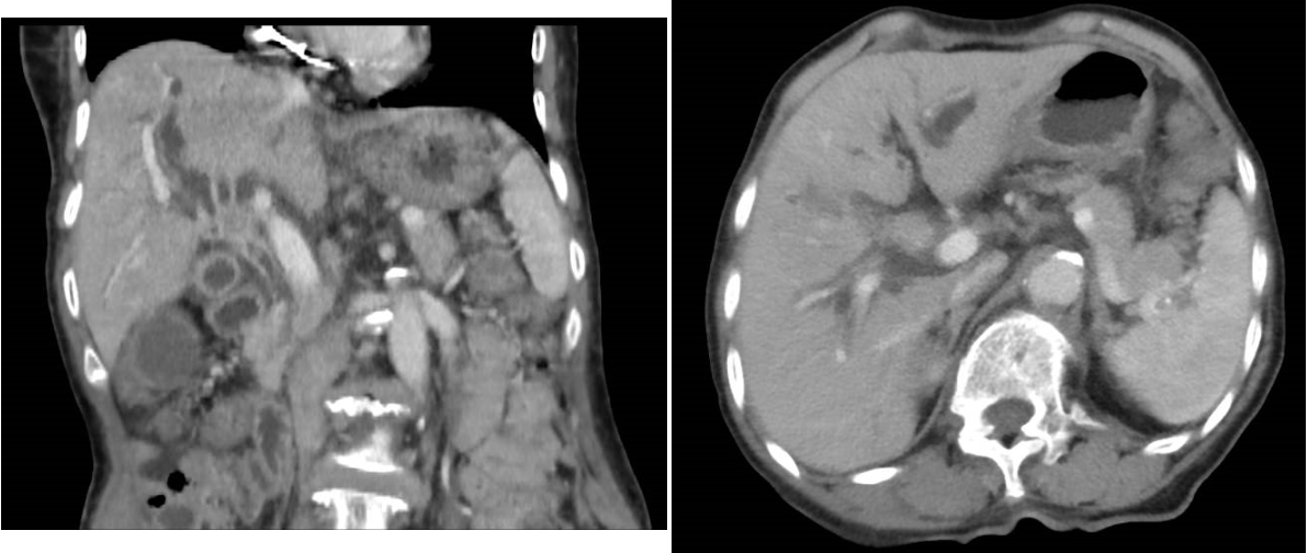 14aaf55403fe802c6cb12017b3442c03.png A1.png