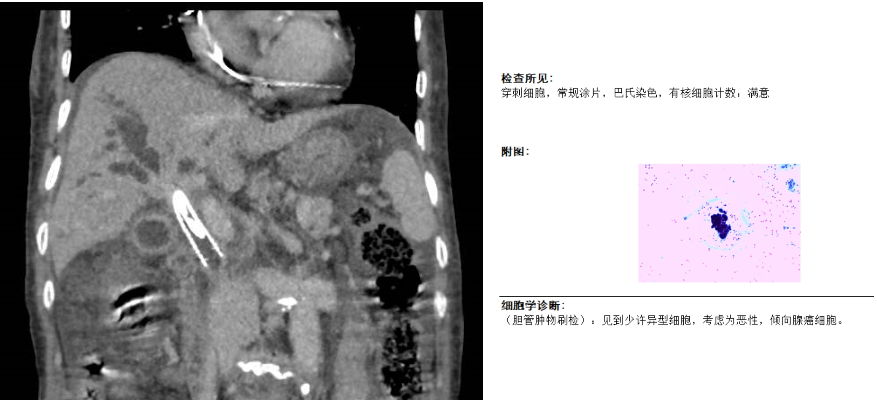 5866c059469a20f538774f7b3824441e.png A11.png